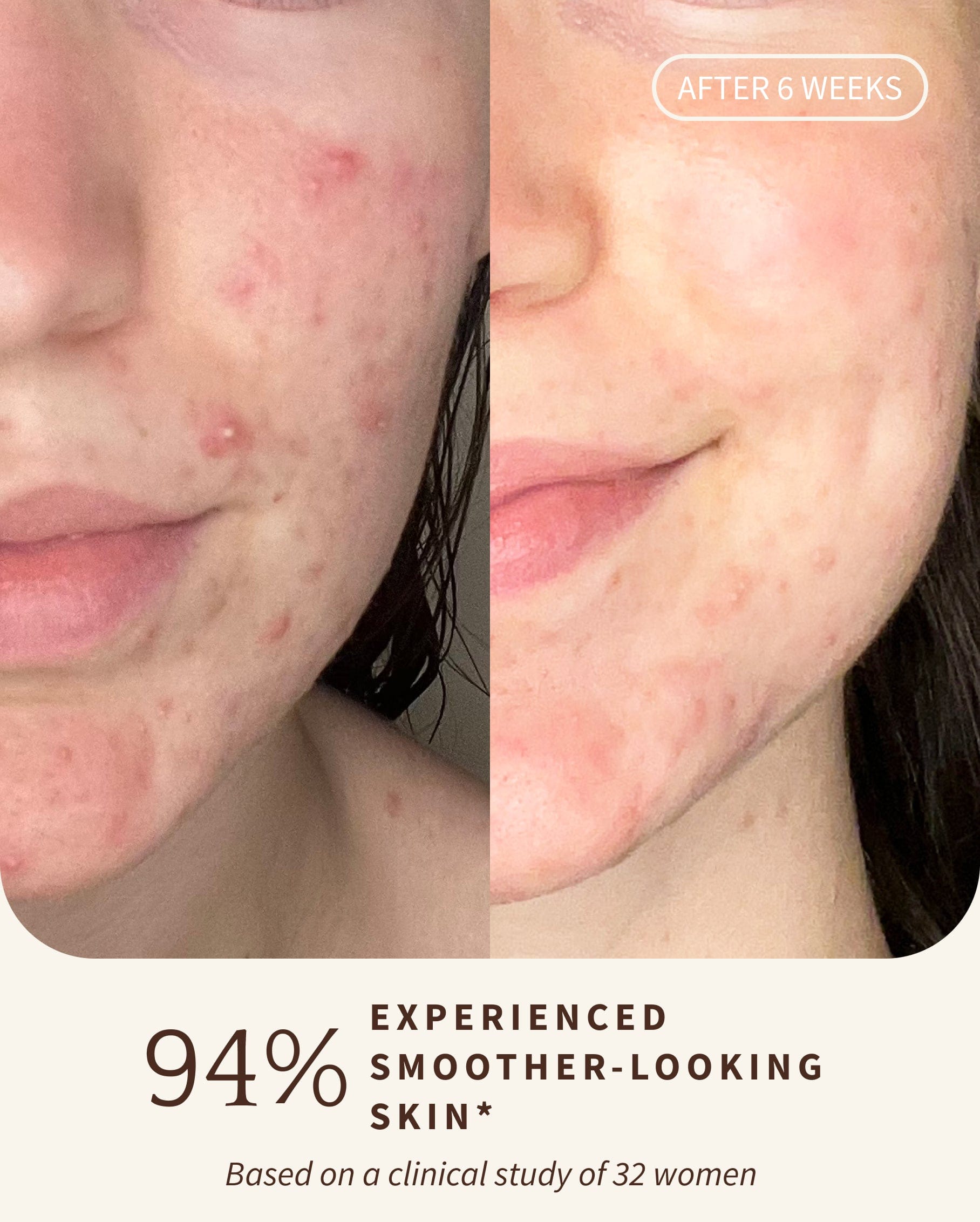3% Bakuchiol BRIGHTENING SERUM