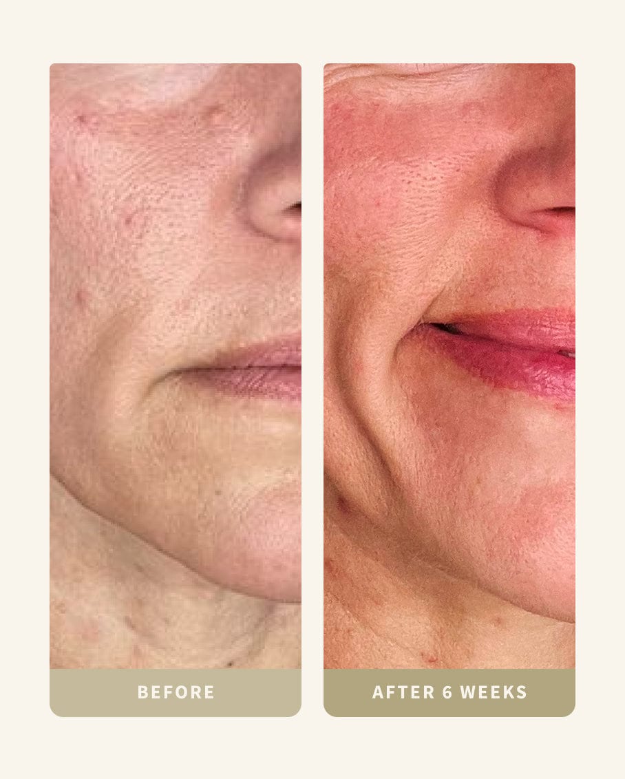 My Custom Routine (Kit G)