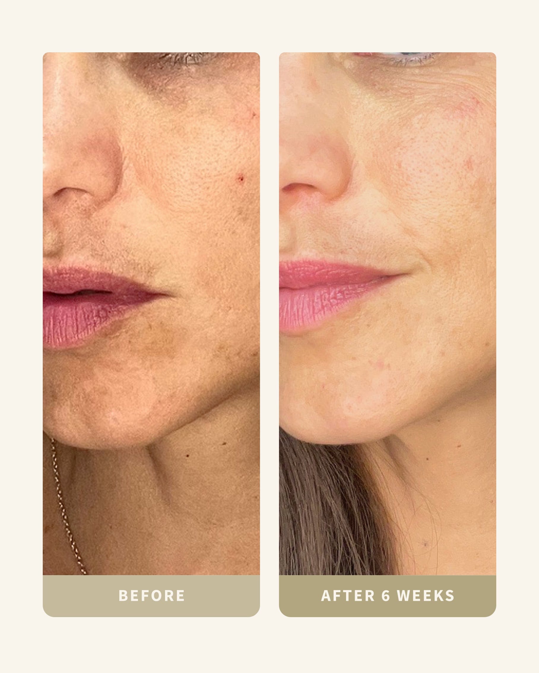 Dry or Sensitive Skin Kit