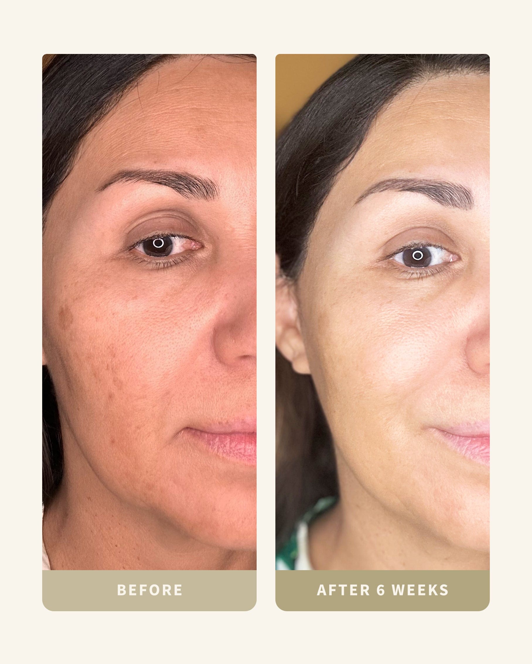 Skin Brightening Kit