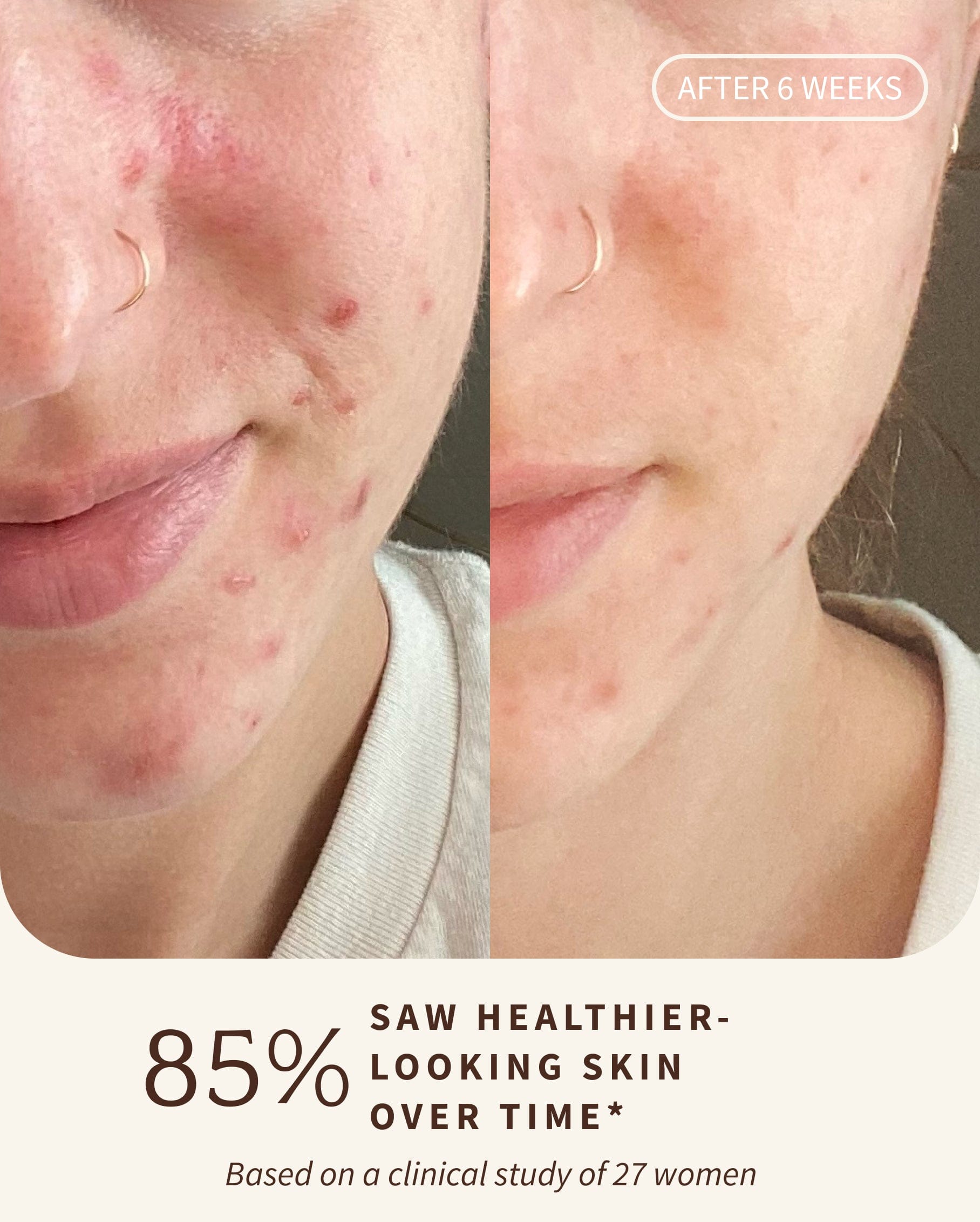 Rosewater CLEANSER