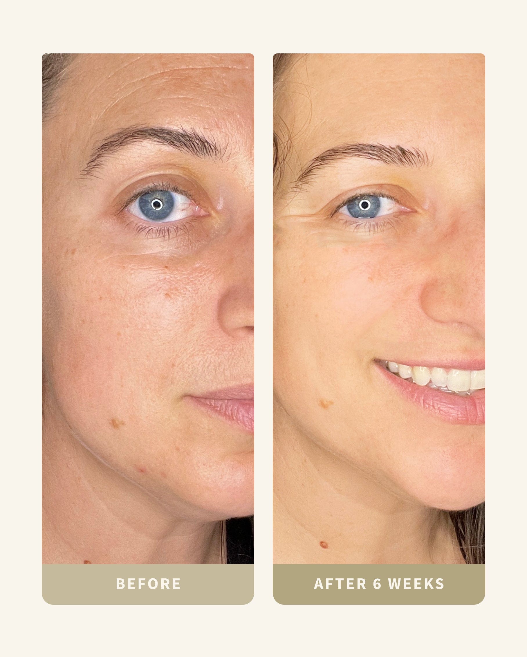 Bakuchiol Double Dose