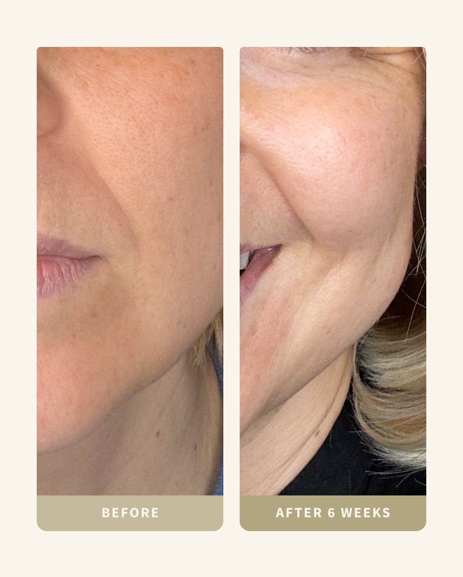 My Custom Routine (Kit BD-A)