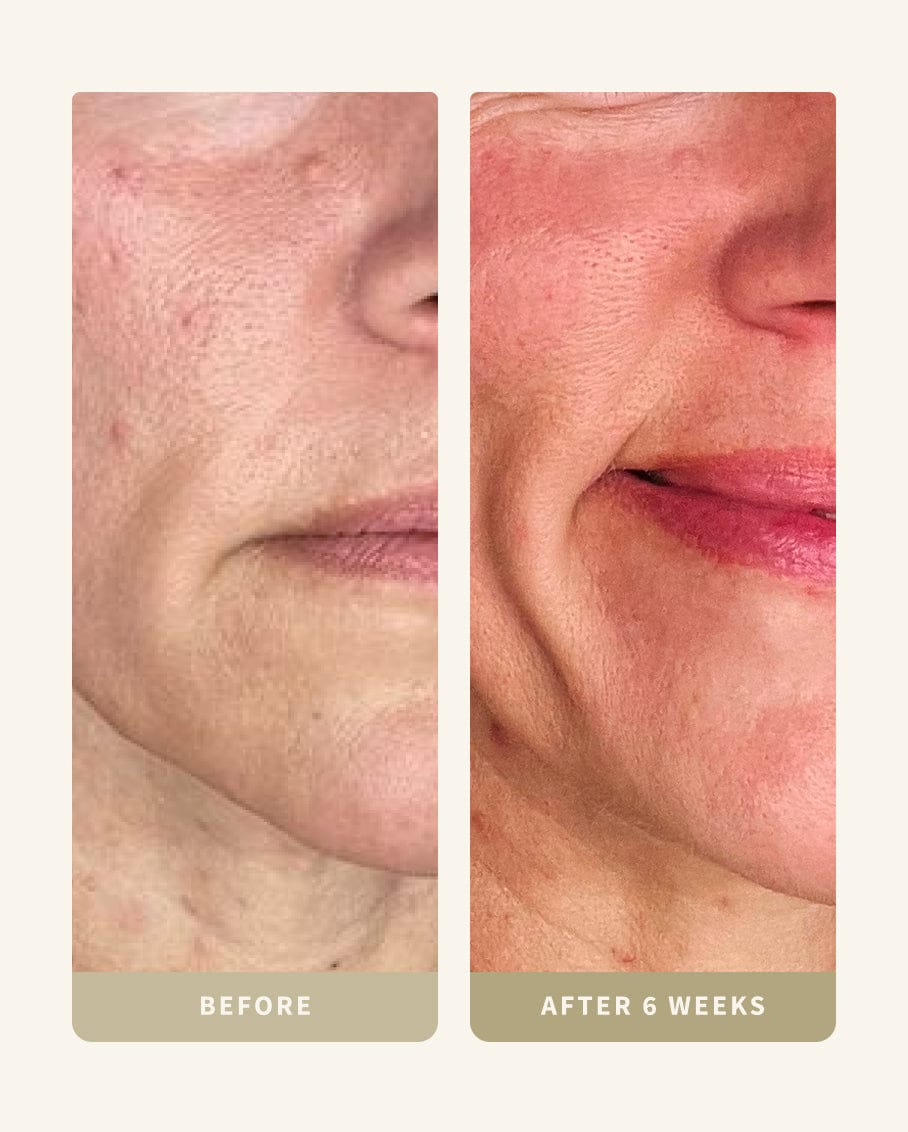 My Custom Routine (Kit BD-B)