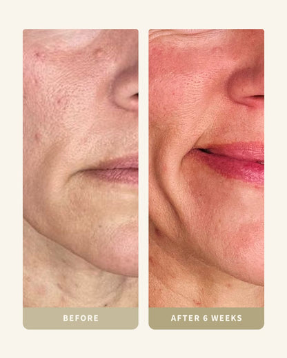 My Custom Routine (Kit BD-B)