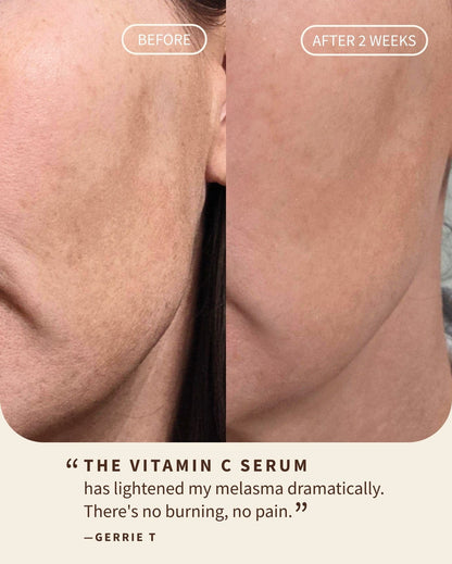 Gentle Vitamin C Glow Serum