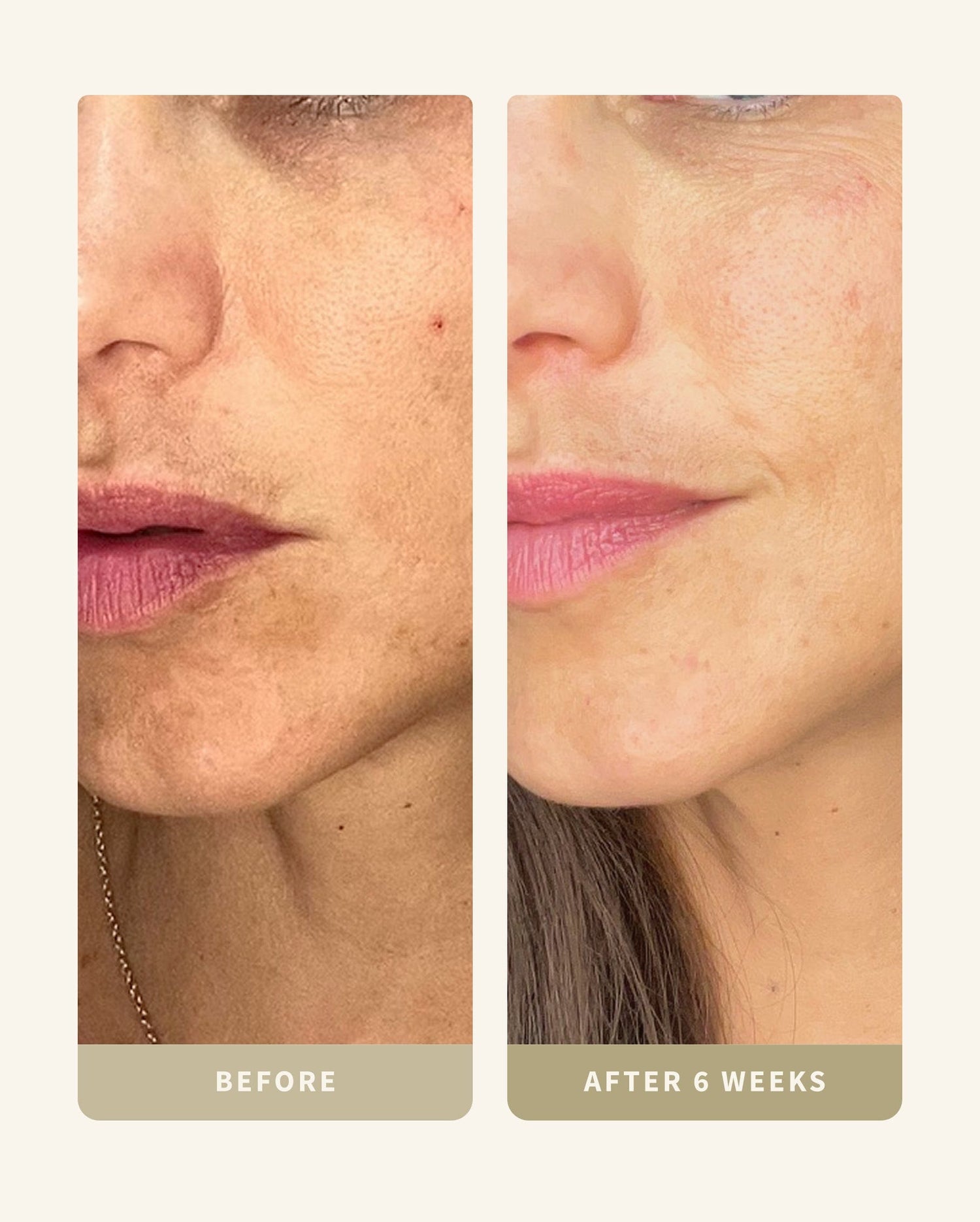 Dry or Sensitive Skin Kit
