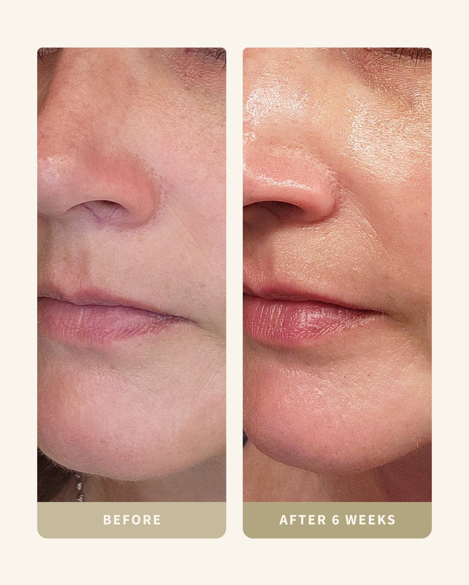 Ultimate Aging Kit