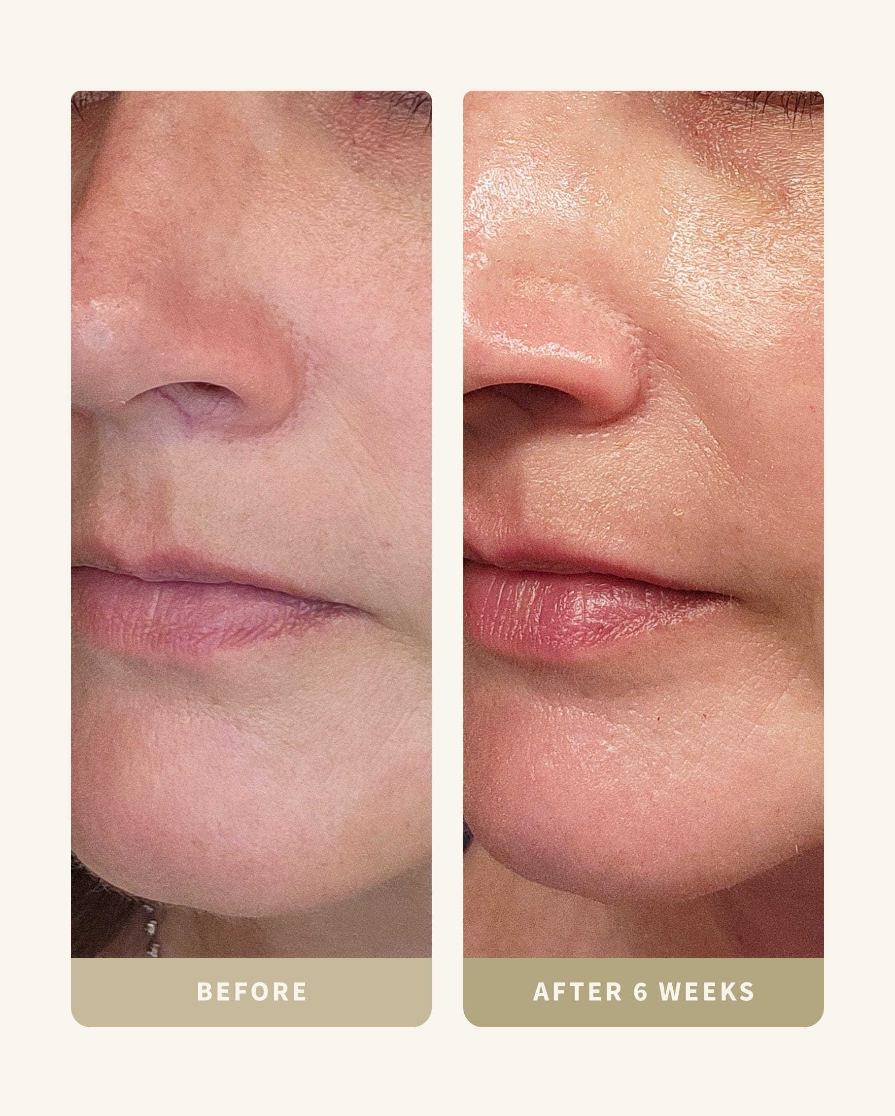 Ultimate Aging Kit