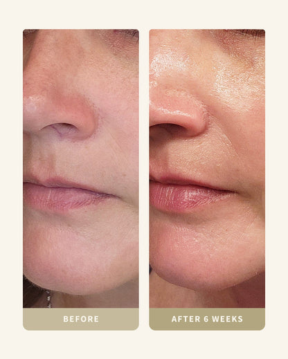 Ultimate Aging Kit