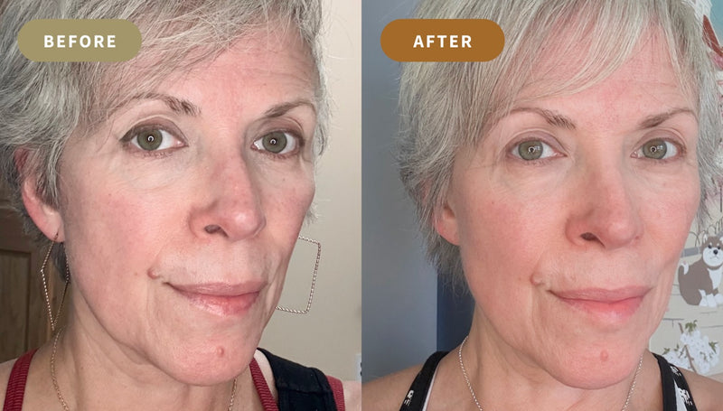 Before and after: the same woman's face, with visibly calmer, more even skin in the after frame.