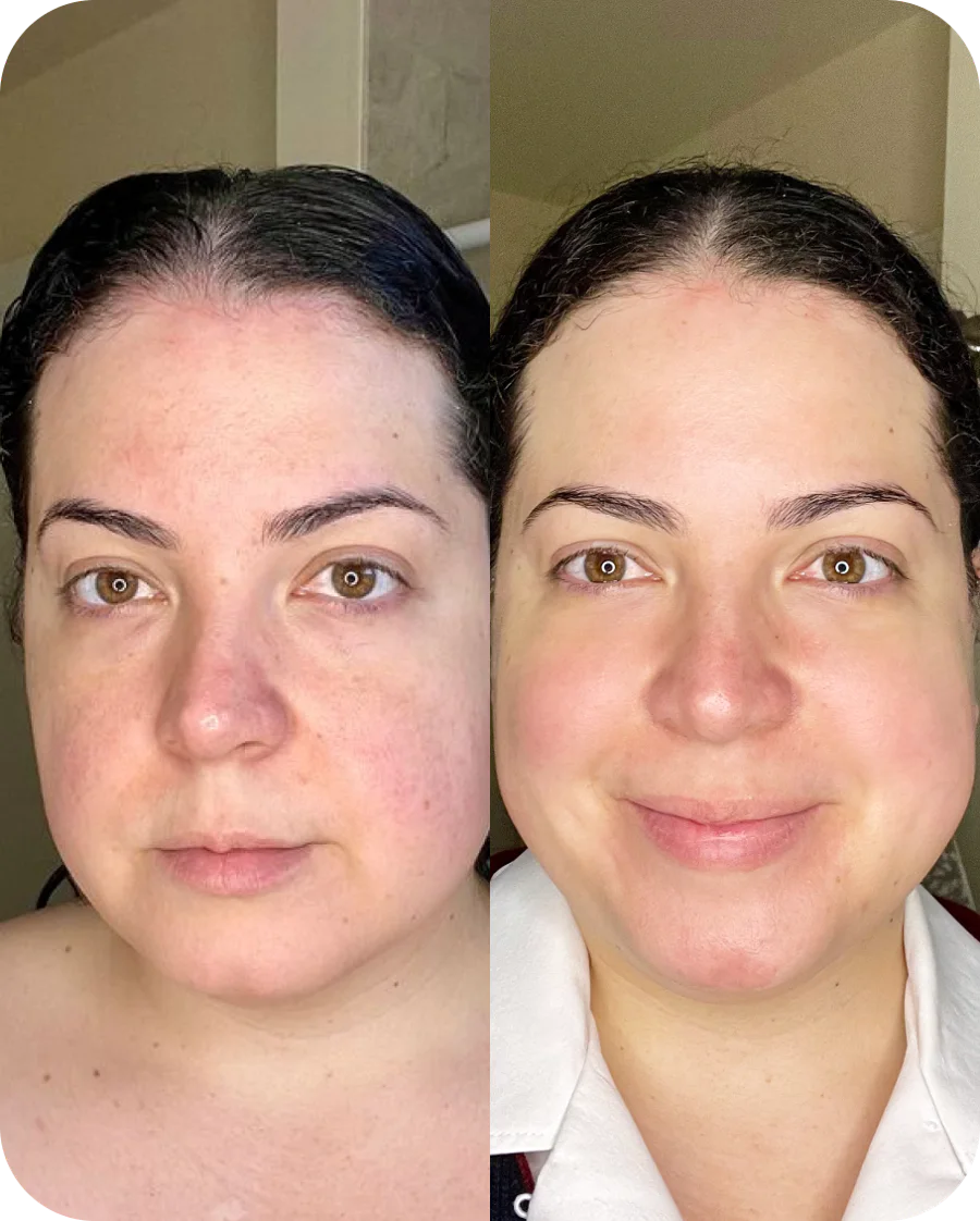 Leilani R. before and after, 6 weeks of use