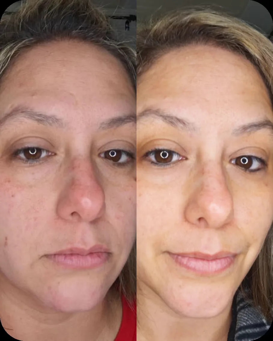 Heather B. before and after, 6 weeks of use