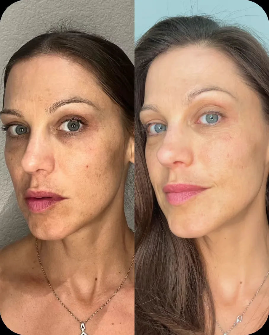 Jennifer B. before and after, 6 weeks of use