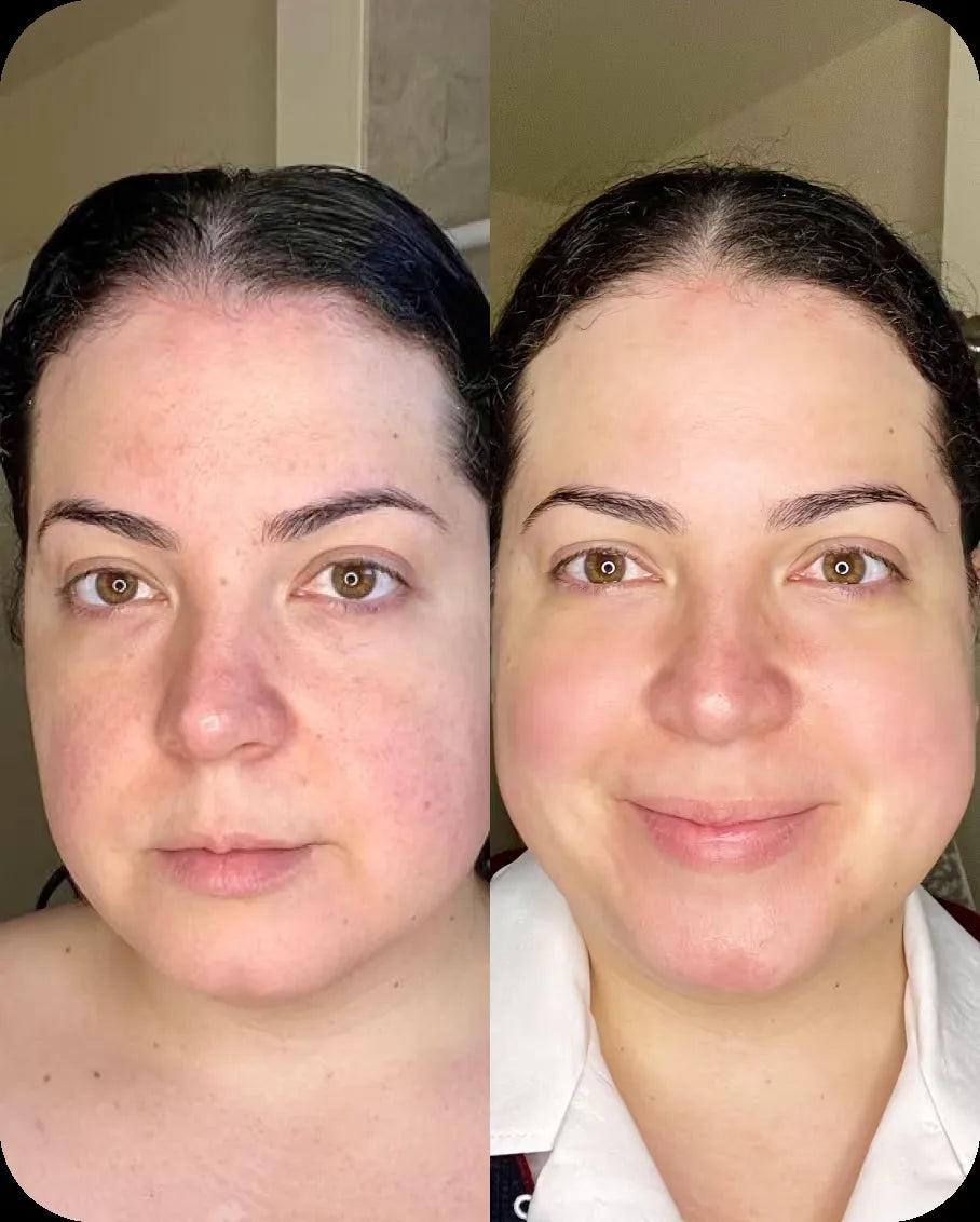 Leilani R. before and after, 6 weeks of use